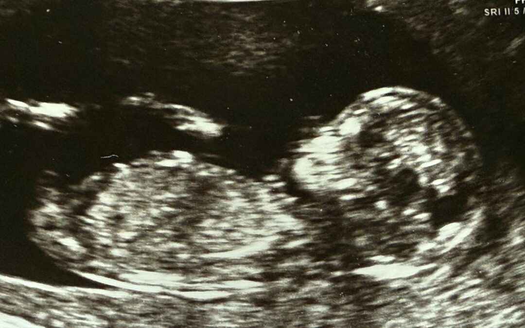 Embryo mix-up to compound IVF parents’ trauma