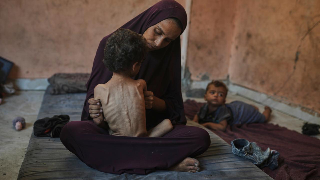 A malnourished child and mother in Gaza
