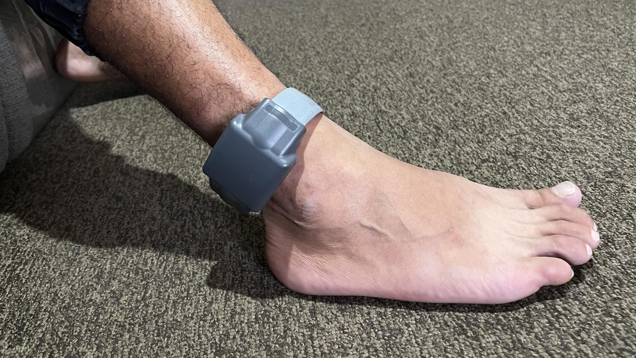 A file photo of an ankle monitor