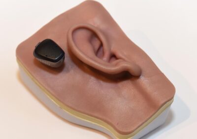 Shares in world-leading hearing implant firm hit a low