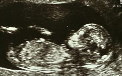 IVF giant again in play after new bid pumps up shares