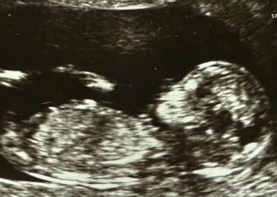 IVF giant again in play after new bid pumps up shares