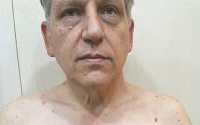 Robert Pether stuck in Iraq. UN experts on torture voice concern