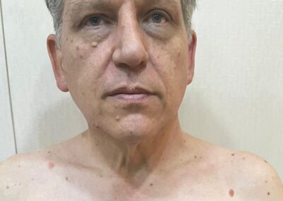 Robert Pether stuck in Iraq. UN experts on torture voice concern
