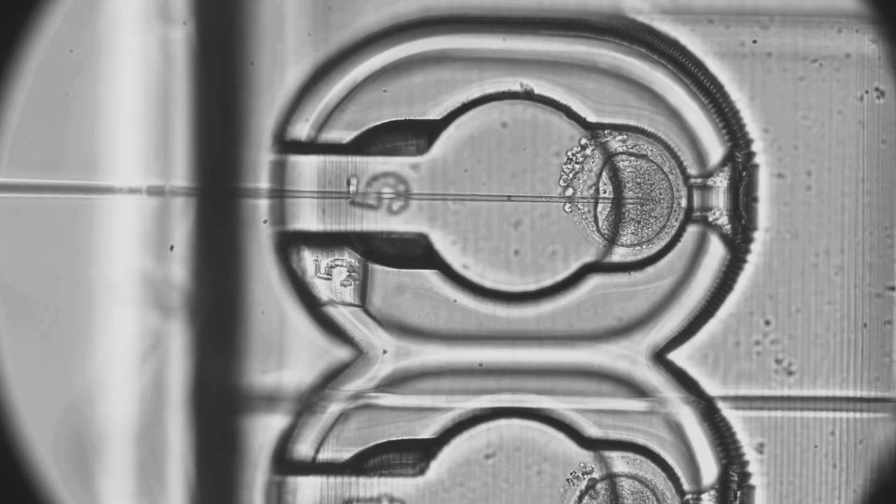 injection of sperm into an egg